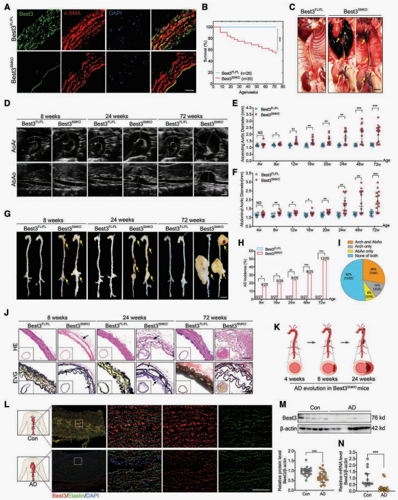 重要发现！暗网范小平教授与中山大学联合团队发现主动脉夹层防治新靶点！