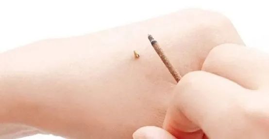 “阳康”后诸多不适怎么办？中医传统疗法来帮忙！