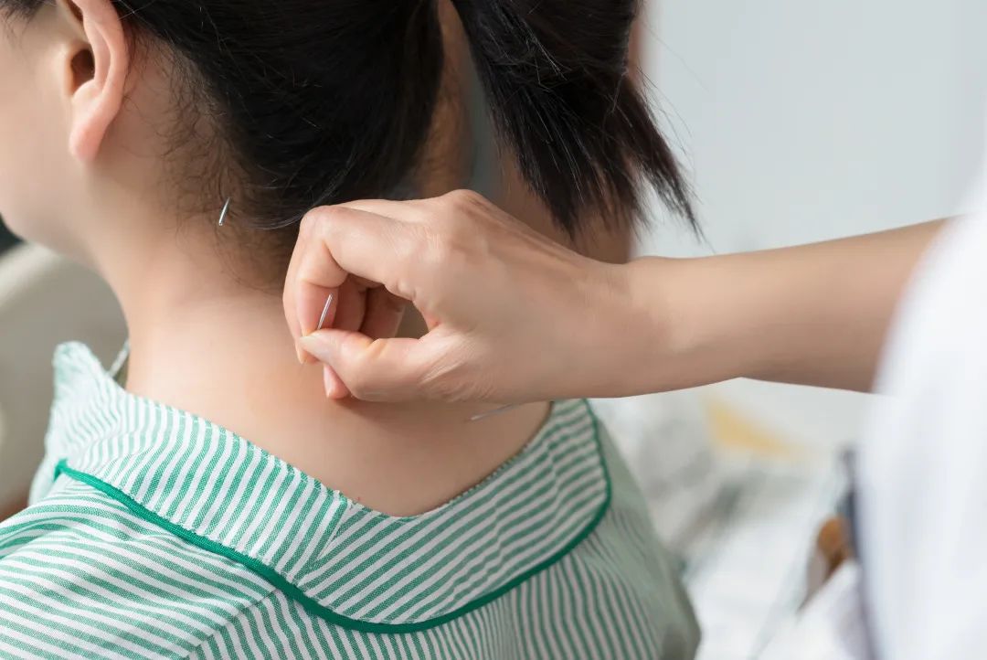 中招“长新冠”？针灸帮你恢复元气！