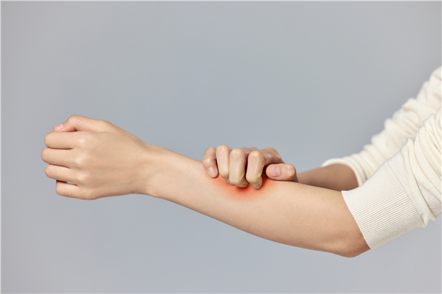 靶向药导致皮疹瘙痒，中医药疗法助力患者高质量抗癌！