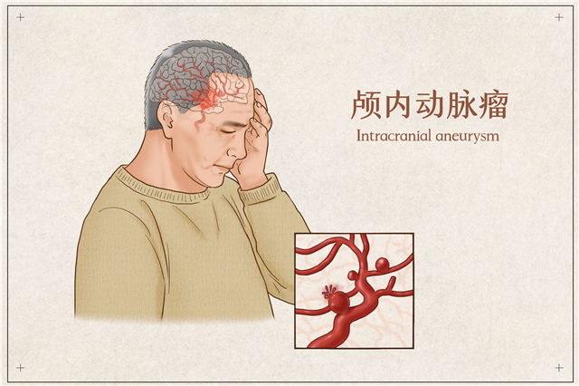 这种疾病是大脑的“定时炸弹”，这项影像技术帮您及早发现隐患！