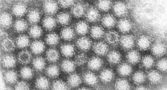 诺如病毒来势汹汹，要如何预防？